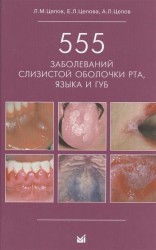 555 заболеваний слизистой оболочки рта, языка и губ