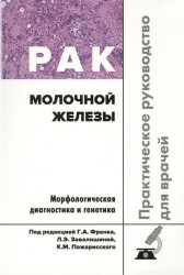 Рак молочной железы. Практическое руководство для врачей